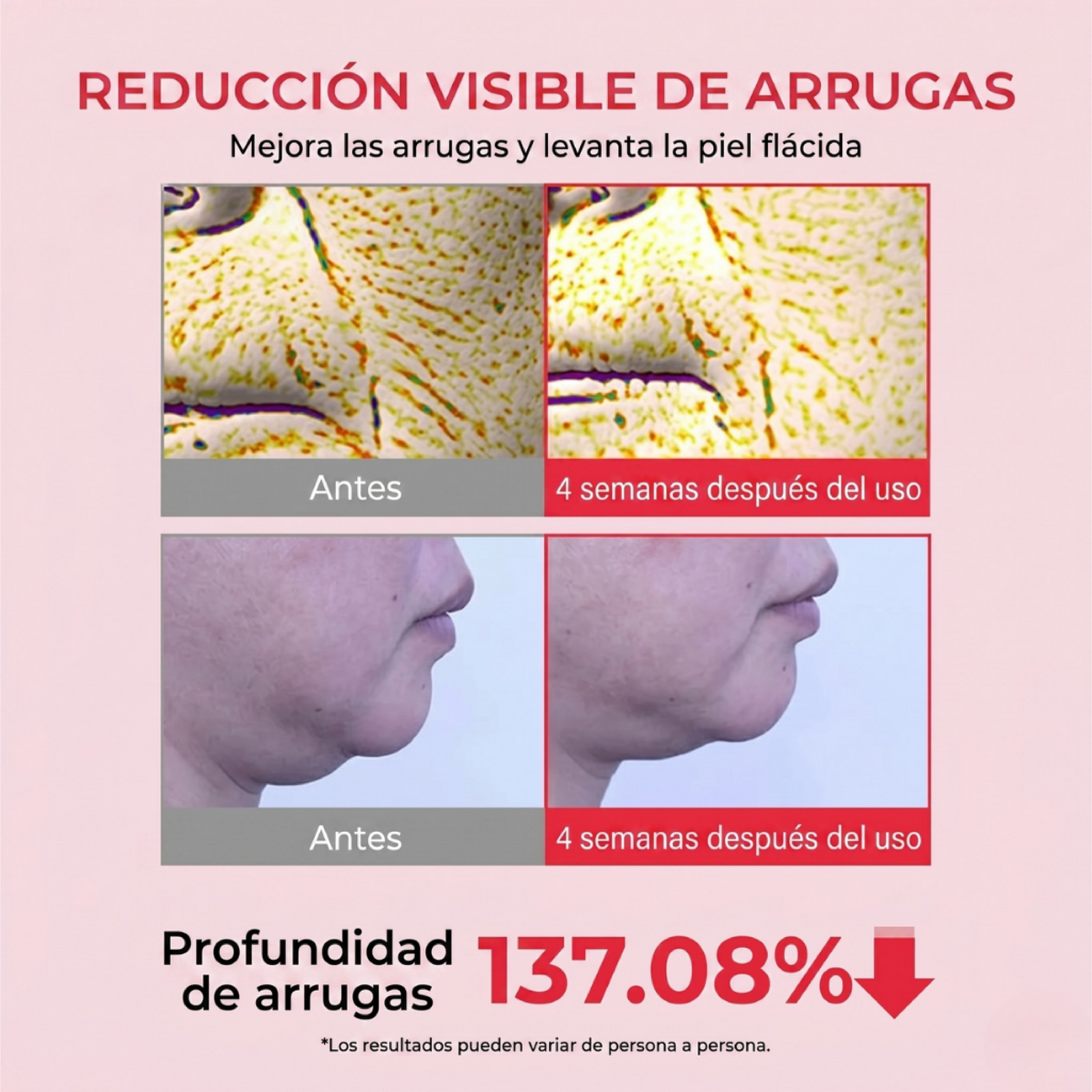 Nuestros resultados