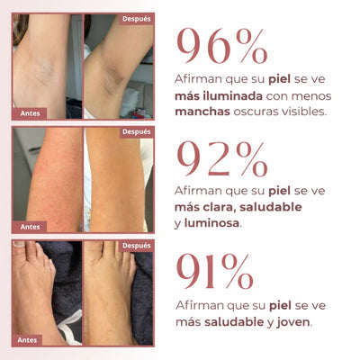 Peel Shot Exfoliante Corporal con Ácido kójico + Cúrcuma