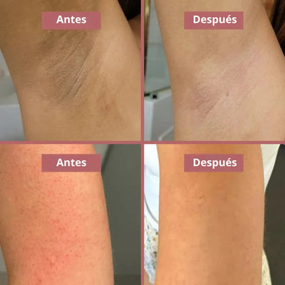 Peel Shot Exfoliante Corporal con Ácido kójico + Cúrcuma