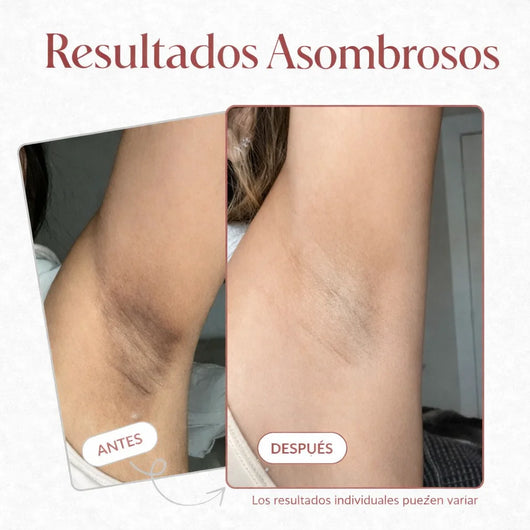 Peel Shot Exfoliante Corporal con Ácido kójico + Cúrcuma