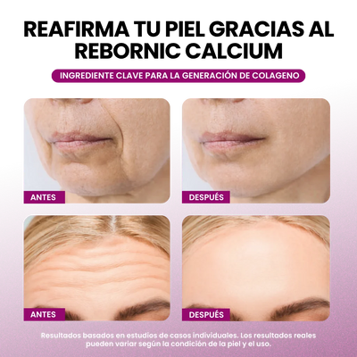 Set potenciador de colágeno