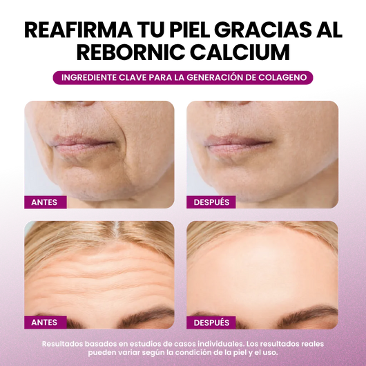 Set potenciador de colágeno