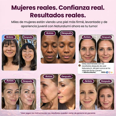 Bálsamo de calcio el botox en barra