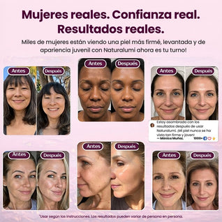 Bálsamo de calcio el botox en barra