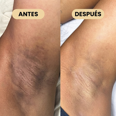 Desodorante con Ácido Kójico y Cúrcuma
