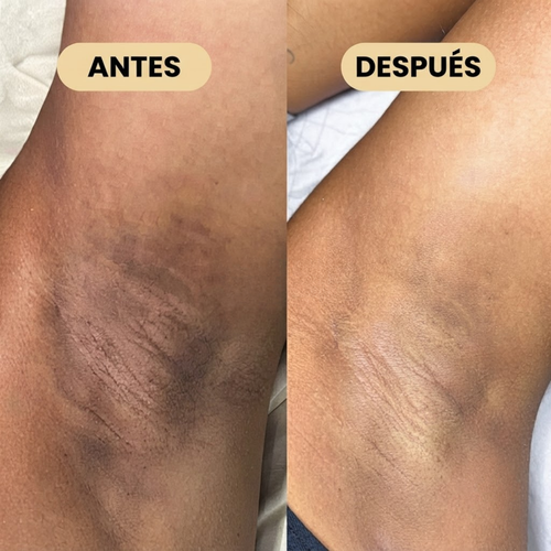Desodorante con Ácido Kójico y Cúrcuma