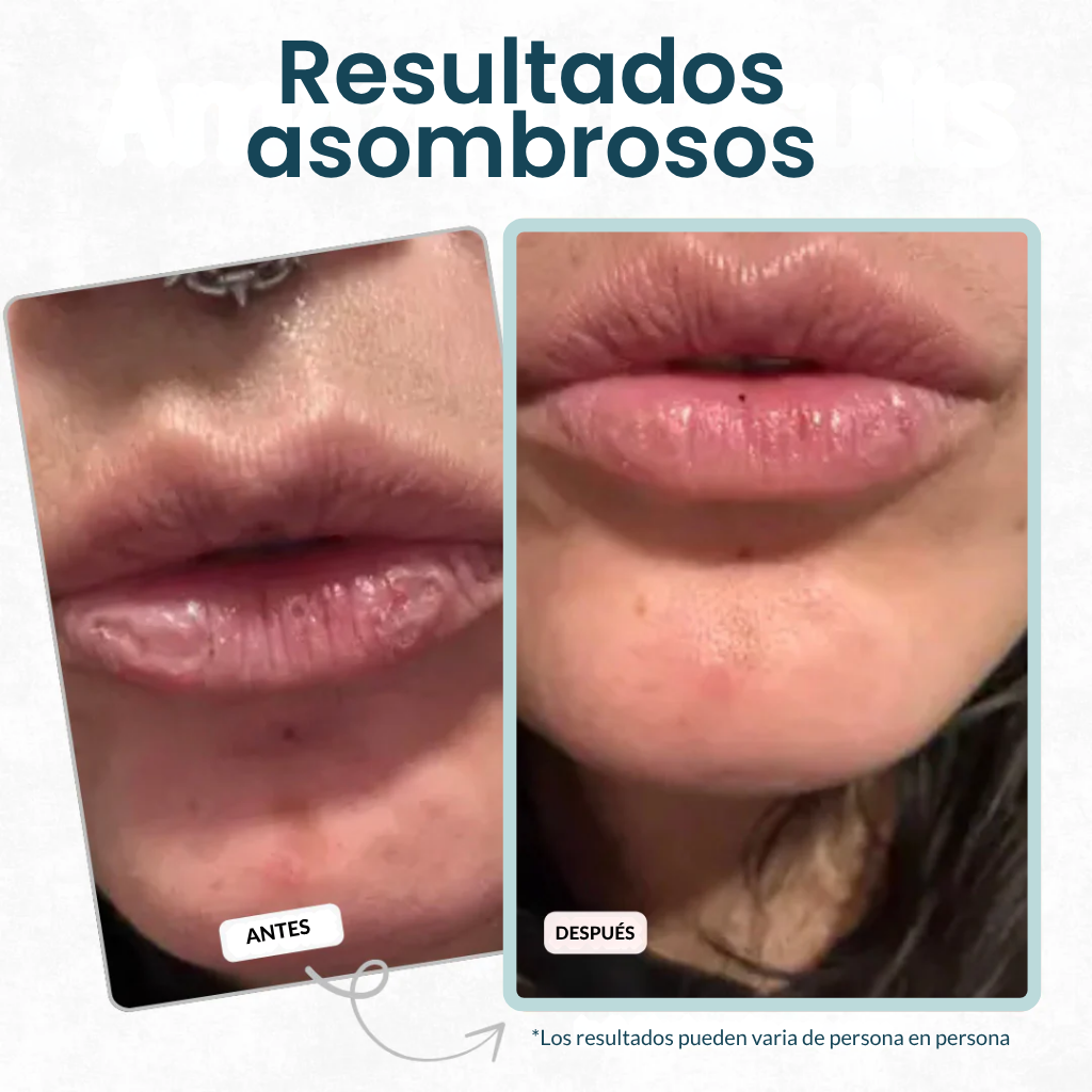 Retire la acumulación seca y revele labios más suaves