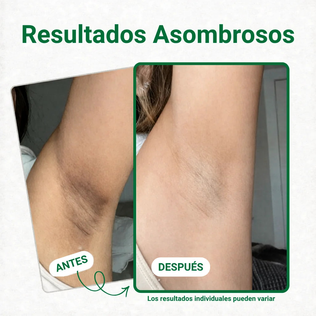 Elimina manchas oscuras en axilas, rodillas y codos