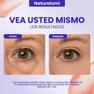 Gel Naturalumi con efecto lifting