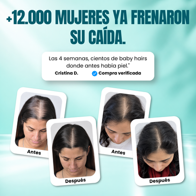 Sérum capilar con PDRN y microagujas