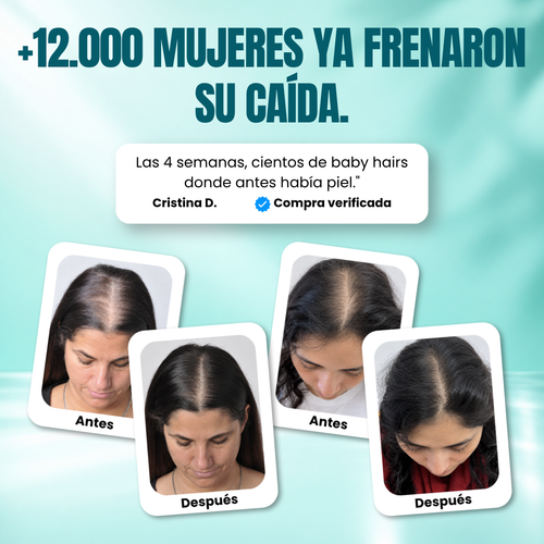 Sérum capilar con PDRN y microagujas