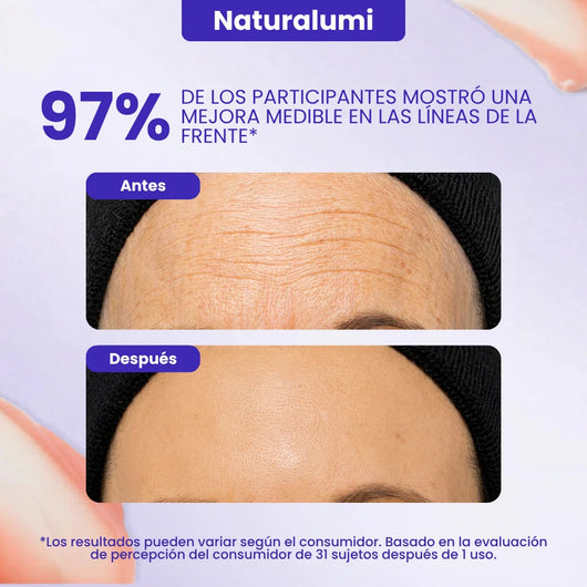 Gel Naturalumi con efecto lifting