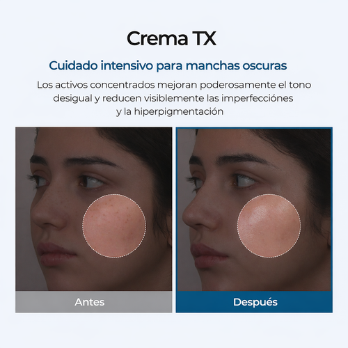 Crema de ácido tranexámico + niacinamida