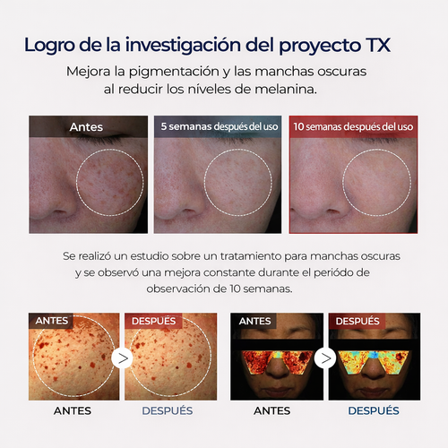Crema de ácido tranexámico + niacinamida