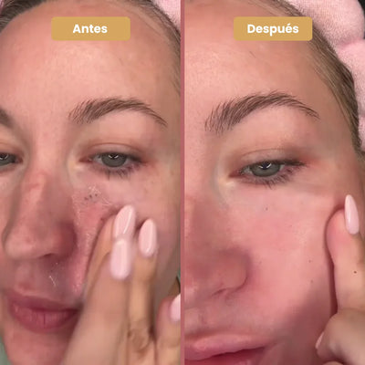Peel Shot Glow Rice Duo