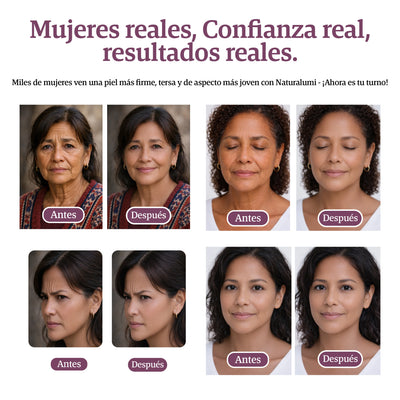 Bálsamo antienvejecimiento de calcio