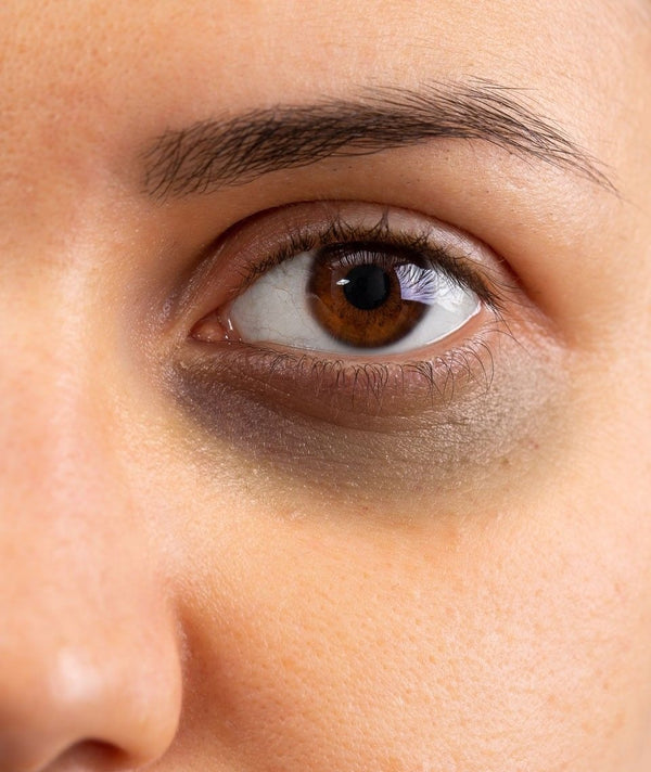 Ojeras