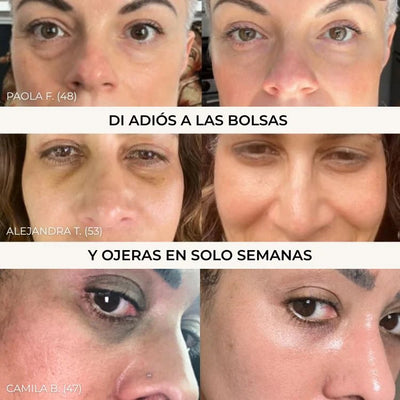 Micro Parches Naturalumi® (Copia)