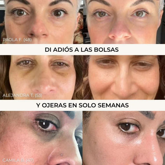 Micro Parches Naturalumi® (Copia)