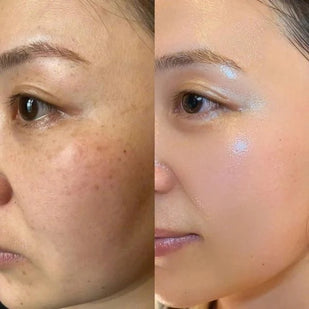 Activador enzimático inteligente