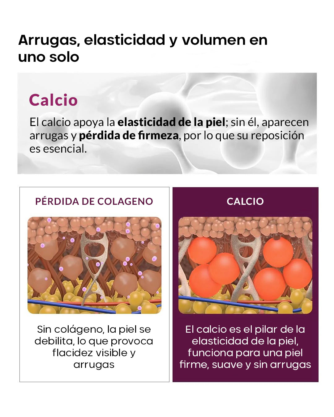 Elementos que reponen.